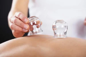 افضل مركز حجامة في القاهرة 2025
